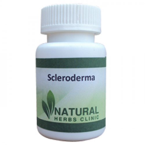 Phototherapy is now considered by some professionals to be the treatment of choice for local scleroderma. Particularly, doctors favor an approach called ultraviolet A-1 radiation. This Scleroderma Treatment produces long UVA wave lengths that do not cause sunburn and may actually repair DNA in damaged skin cells.... http://www.naturalherbsclinic.com/scleroderma/scleroderma-treatment-for-skin-thickening