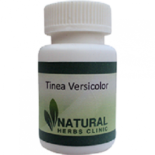 There are a few home remedies and herbal remedies and Natural Treatment for Tinea Versicolor that you can try, but the efficacy of most of these remedies remains questionable, as they are not subjected to the rigorous testing applied to pharmaceuticals.... http://www.naturalherbsclinic.com/tinea-versicolor/tinea-versicolor-natural-treatment