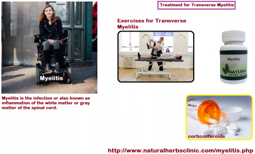 Acute Transverse Myelitis Treatment is directed at the cause or connected disorder but is otherwise helpful. In idiopathic cases, high-dose corticosteroids are frequently given and sometimes followed by plasma exchange because the cause may be autoimmune. Effectiveness of such a routine is uncertain.... http://www.naturalherbsclinic.com/transverse-myelitis-prognosis