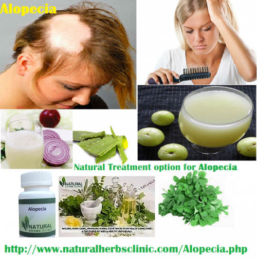 To spare from behind their hair, we have put together Natural Treatment for Alopecia for men and women who suffering hair loss. But a lot of precautions must be taken in administering these medicines to your young ones. Make sure to first discuss with a professional before doing so.... http://alopecianaturaltreatment.blogspot.com/2017/03/alopecia-natural-treatment.html