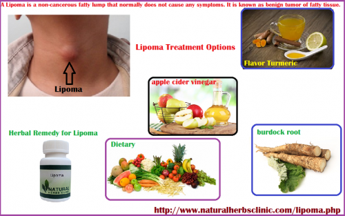 So, it’s best to use Natural Treatment for Lipoma. Apple cider vinegar stands best in treating Lipoma without any side effects and cost effective... http://naturalherbsclinic.jigsy.com/entries/skin-and-beauty/lipoma-prevention-with-natural-treatment