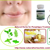 B-Natural-Herbs-for-Pemphigus