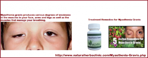 ocular-myasthenia-gravis-treatment-myasthenia-gravis-alternative