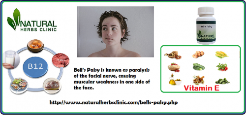 Bell’s Palsy Treatment depends on the severity of the disease and sort of symptoms – lots of recover without medication. Anti-inflammatory drugs and/or antiviral therapies are generally indicated, although various studies question the effectiveness of this treatment routine.... http://herbsclinic.edublogs.org/2017/11/01/bells-palsy-prevention-with-natural-remedies/