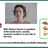 Bells-Palsy-Prevention-with-Natural-Remedies