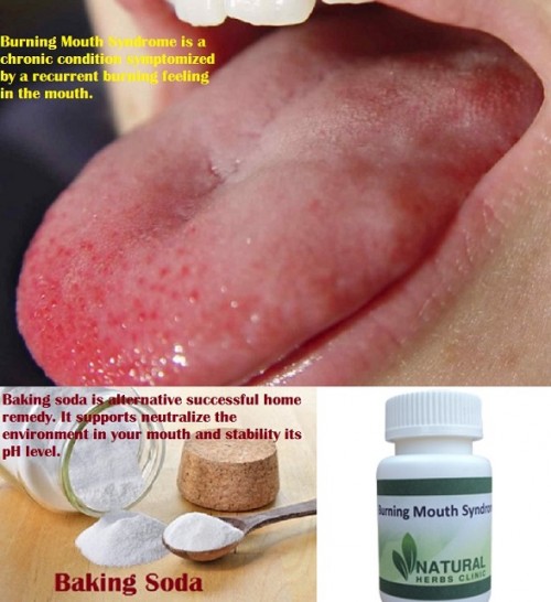 Baking soda can support contest a mouth infection and extra development of yeast inside your mouth. This supports decrease the Burning Mouth Syndrome symptoms and stop more problems.... http://burningmouthsyndrometreatment.blogspot.com/2017/02/burning-mouth-syndrome-symptoms-and-its.html