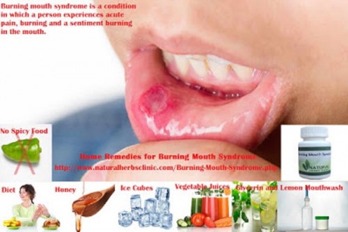 The Burning Mouth Syndrome Symptoms may include. Loss of taste, your lips, gums, sense of taste, throat or entire mouth, A vibe of dry mouth with expanded thirst, Taste changes, for example, a biting or metallic taste and A burning or singed vibe that most commonly influences your tongue, however may also influence  The discomfort from burning mouth syndrome regularly has a few unique examples... http://burningmouthinfection.blogspot.com/2016/10/6-home-remedies-for-burning-mouth.html