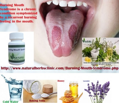 Honey is one of the effective Burning Mouth Syndrome home remedies that can support soothe the burning feeling and even support fight infection. It can also decrease pain and inflammation.... http://burningmouthsyndrometreatment.blogspot.com/2017/02/burning-mouth-syndrome-symptoms-and-its.html