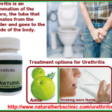 CUrethritisHomeTreatmentNaturalTreatmentforUrethritisTreatmentofUrethritis-NaturalHerbsClinic