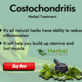 Costochondritis