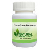 Granuloma-Annulare-Herbal-Treatment-228x228