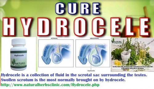 Get information about remedies to treat hydrocele from your trusted way Natural Herbs Clinic. We have Hydrocele Herbal Remedies for the successful treatment of hydrocele... http://www.naturalherbsclinic.com/Hydrocele.php
