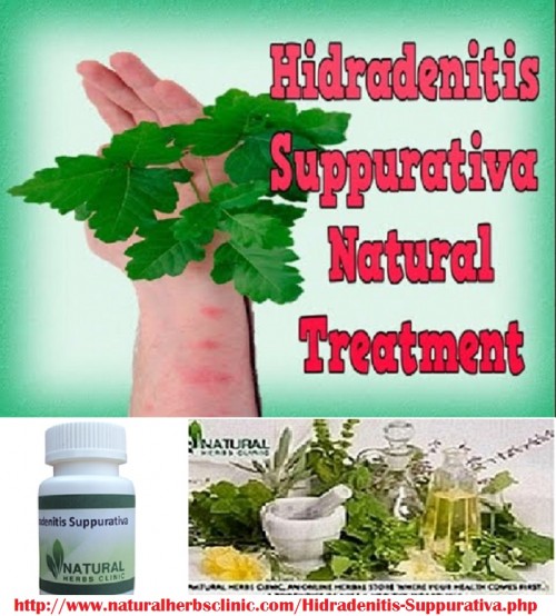 Getting an early determination and hidradenitis suppurativa natural treatment is important to prevent the condition from progressing and scars from forming... http://hidradenitissuppurativatreatment.snack.ws/