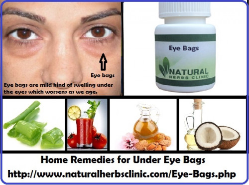 looking for the right Best Treatment for Eye Bags requires you to learn which ingredients can really bring forth the results you are looking for and not just half-hearted and semi-delivered results.... https://naturalcureproducts.wordpress.com/2017/09/14/how-to-get-rid-of-eye-bags-permanently/