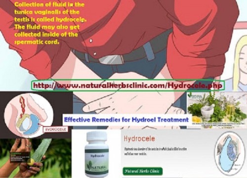 There are many resources are available in market for Hydrocele Natural Treatment. One of them is Hydrocele Herbal Remedy prepared by Natural Herbs Clinic. This product has successful result in treatment of hydrocele problem.... http://hydroceles.blogspot.com/2016/12/hydrocele-causes-symptoms-and-natural.html