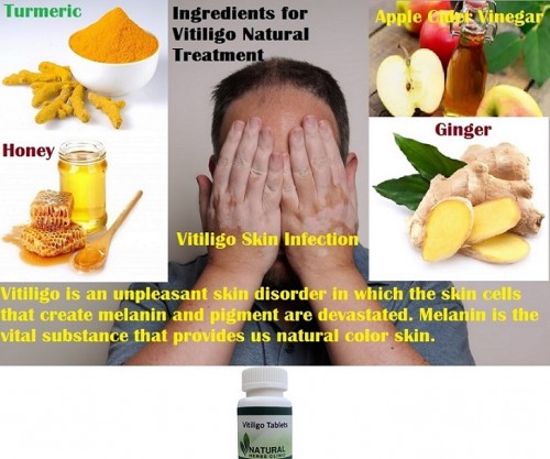 Turmeric, Apple Cider Vinegar, Honey and Ginger are some useful herbal ingredients which can be used for Vitiligo Natural Treatment. These ingredients are work to remove vitiligo white patches without any side effects.... http://www.naturalherbsclinic.com/blog/symptoms-and-natural-treatment-method-for-vitiligo/