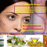 Keloids-Scar-Symptoms-and-Natural-Herbal-Treatment