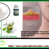 Lipoma-Herbal-Treatment