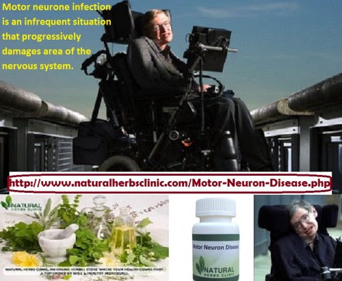 MND is an incurable disease destroying the body’s cells which control movement causing progressive disability. Present treatment options for those with Motor Neurone Disease only have a modest effect in improving the patient’s quality of life.... http://www.naturalherbsclinic.com/blog/new-research-helps-fight-against-motor-neurone-disease/
