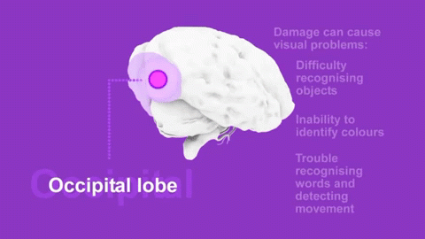 Occipital-Lobe.gif