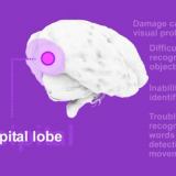 Occipital-Lobe