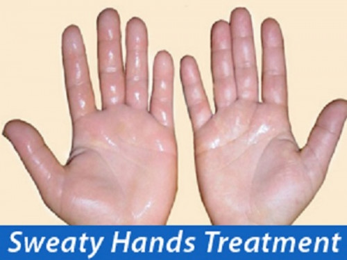 Another successful Sweaty Hands Treatment remedy is stress management. You tend to sweat a lot when you are feeling stressed. Grab every break opportunity while you are at work... http://hyperhidrosisdisorder.blogspot.com/2017/10/natural-treatment-for-hyperhidrosis.html