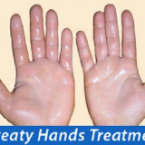 Sweaty-Hands-Treatment