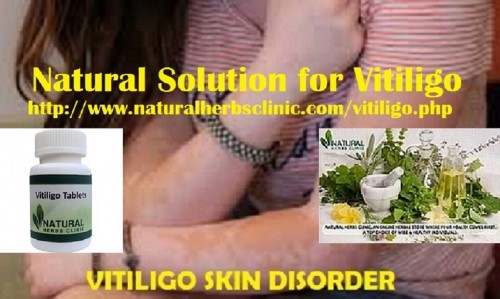 Natural Treatment for Vitiligo that will support you gets your clear and smooth skin for not also extended. It is vital to see a health professional to evaluate your specific situation, offer an exact diagnosis and for treatment.... http://www.naturalherbsclinic.com/blog/natural-treatment-for-vitiligo/