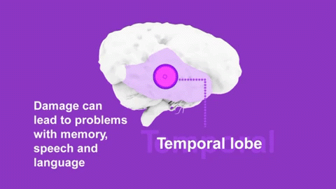 Temporal-Lobe.gif