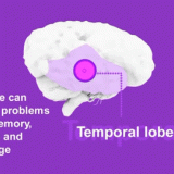 Temporal-Lobe