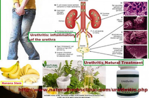 Treatment of Urethritis with somewhat rare herb has antibacterial and antiviral effects, making it a powerful immune system booster that can help to get better quickly from a bout of urethritis.... https://naturalcureproducts.wordpress.com/2017/10/14/natural-treatment-for-urethritis/