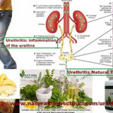 Urethritis-Natural-Treatment