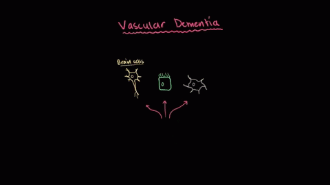 Vascular-Dementia.gif