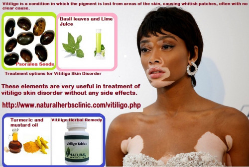 It leads us to the conclusion that the remedies and the Vitiligo Treatment Options are not very simple and straight forward if we don't have proper knowledge about it.... https://www.solaborate.com/naturalherbs-clinic/blog/the-bestway-to-get-rid-of-vitiligo-without-side-effect/aec254ca-24ee-4a75-9c10-ae59b976a25f