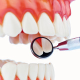 periodontal-flap-surgery