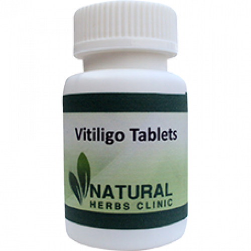 If you are affected with vitiligo and want to complete solution then contact us. We have Vitiligo Herbal Remedy for your vitiligo treatment naturally. Order us now and get relief from your vitiligo problem.... http://www.naturalherbsclinic.com/vitiligo.php